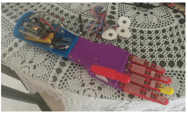 Assembled prosthetic hand with the electronics inside the socket